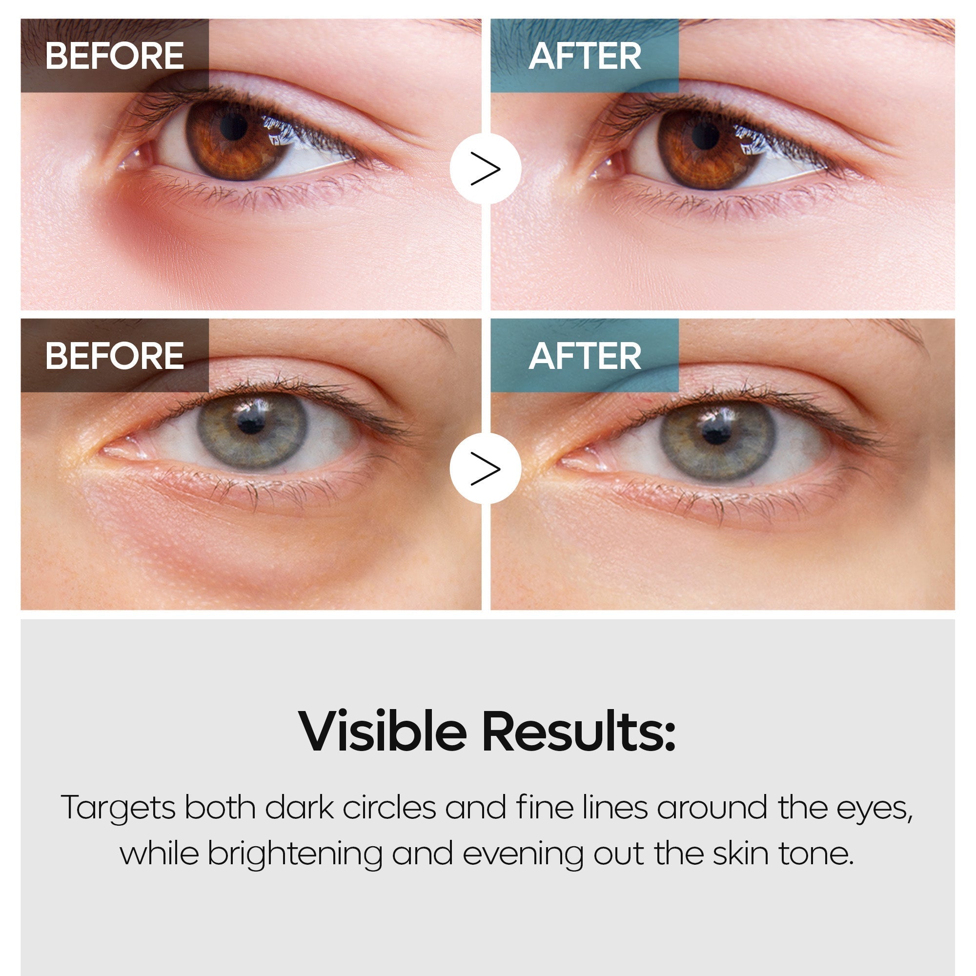TX Eye Care Toner Set